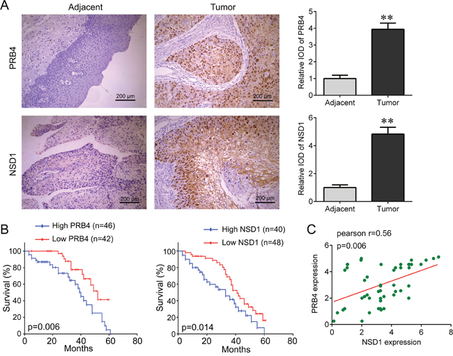 PRB4 and NSD1 are increased in human hypopharyngeal carcinoma tissues.