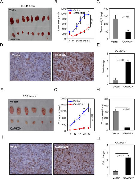 CAMK2N1 inhibits prostate tumor growth in vivo.