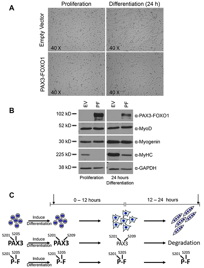 The stable expression of PAX3-FOXO1 inhibits terminal myogenic differentiation.