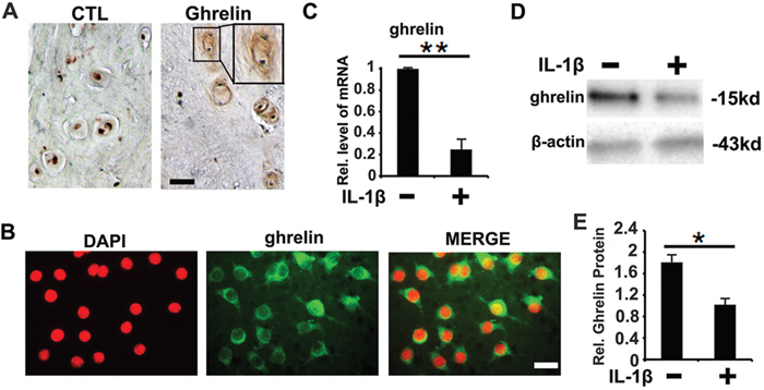 Expression pattern of ghrelin in NP cells.