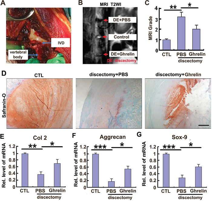 Ghrelin protects against destruction of NP tissue in a rabbit IVD degeneration model.