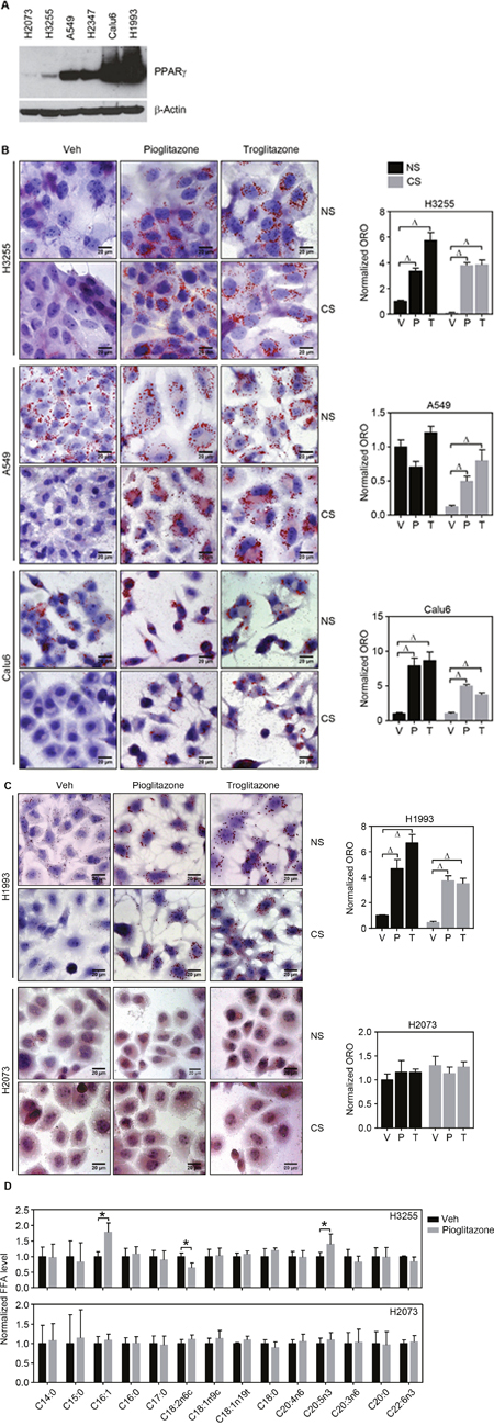TZD treatment induces de novo lipid synthesis in lung cancer cells.