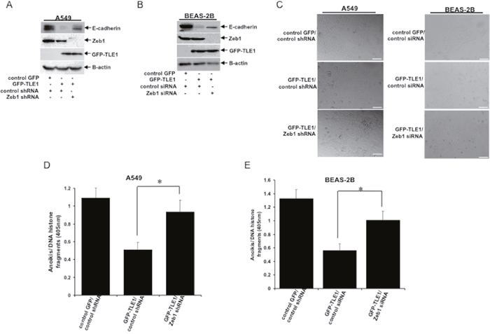 Knockdown of ZEB1 attenuated the TLE1-induced E-cadherin repression and anoikis resistance.