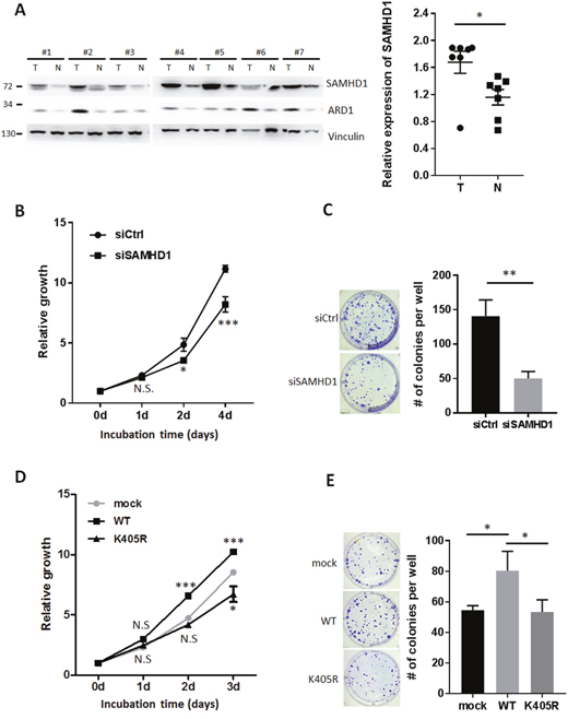 SAMHD1 acetylation is important for cell proliferation in various cancer cells.