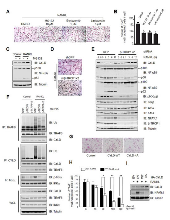 &#x3b2;-TRCP regulates osteoclast differentiation in part through modulating CYLD abundance to influence the activation of NF-&#x3ba;B signaling pathway