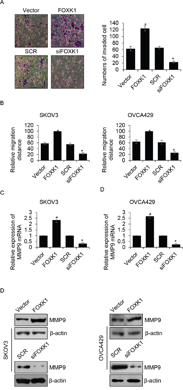 FOXK1 improves the migration and invasion ability of ovarian cancer cells.