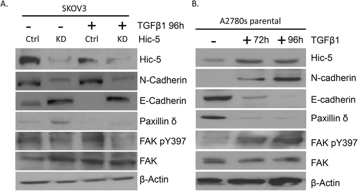 Effect of TGF&beta;1 treatment on Hic-5 knockdown and A2780s parental EOC cells.