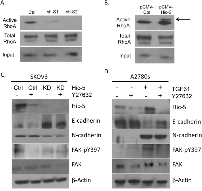 Assessment of RhoA activity and ROCK inhibition in EOC cells.