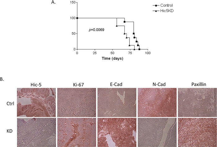 In vivo examination of the effect of Hic-5 knockdown in tumor formation and survival in immunodeficient (SCID) mice.