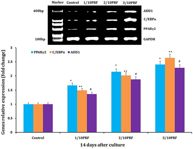 mRNA levels of PPAR&#x03B3;2, C/EBP&#x03B1; and ADD1 mRNA, which are adipogenic marker genes, were much higher in the PRF groups than in the control group after 14 days of culture.