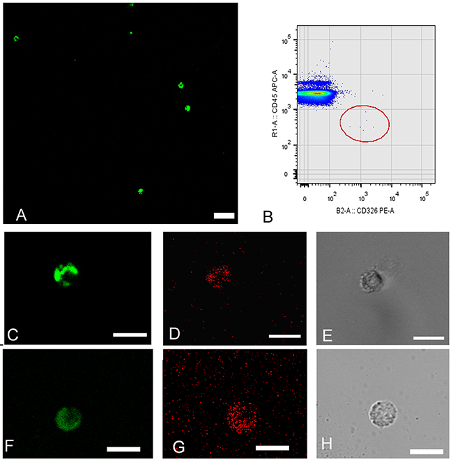 Circulating tumor cells (CTCs) isolated from peripheral blood samples obtained from patients diagnosed with stage IV lung adenocarcinoma presenting ALK rearrangements.