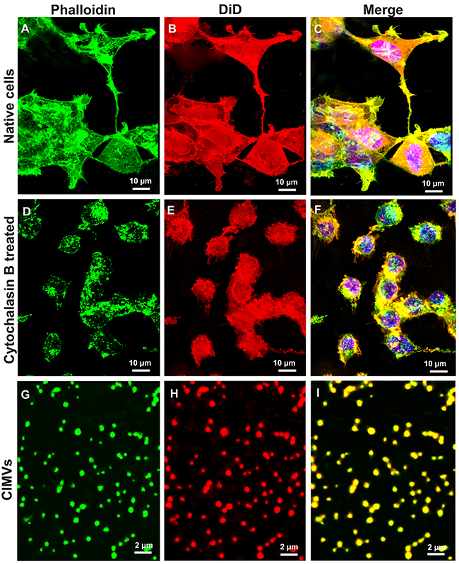 Comparison of the actin cytoskeleton structure in native and cytochalasin B treated cells and presence of actin filaments in CIMVs.