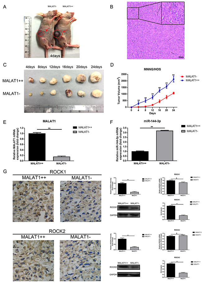 Up-regulation of MALAT1 promoted tumorigenesis of osteosarcoma in vivo.