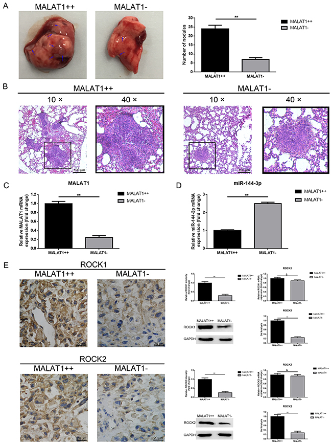 Up-regulation of MALAT1 promoted pulmonary metastasis of osteosarcoma in vivo.