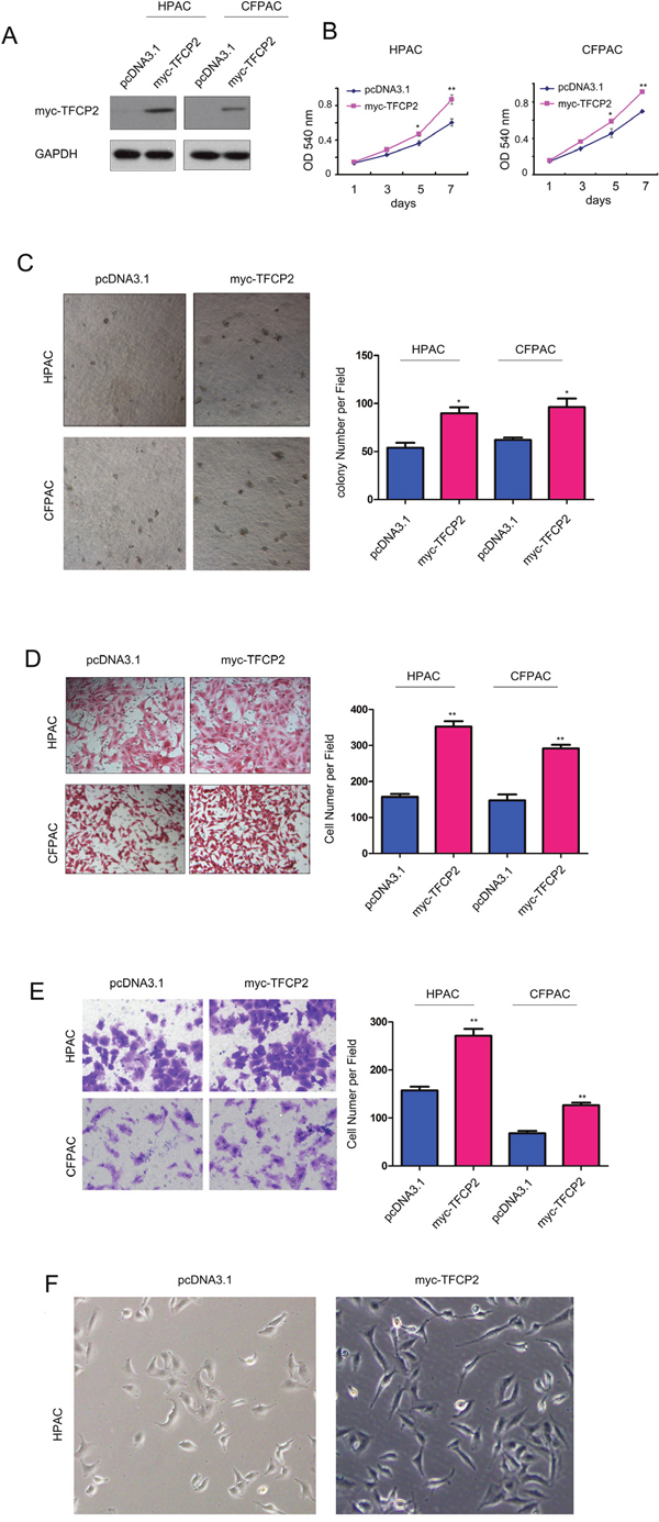 Overexpression of TFCP2 promoted the growth, migration and invasion of pancreatic cancer cells.