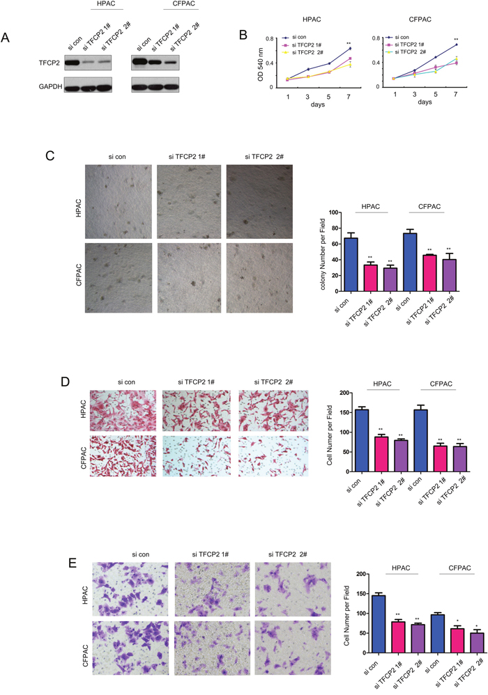 Knocking down the expression of TFCP2 inhibited the growth, migration and invasion of pancreatic cancer cells.