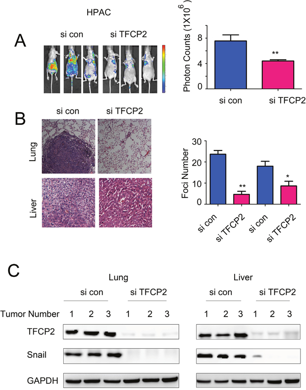 Knocking down theexpression of TFCP2 inhibited the metastasis of HPAC cells in vivo.