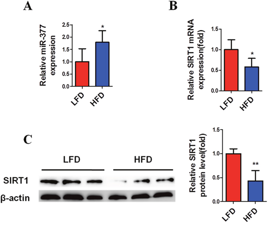 MiR-377 is upregulated by HFD in adipose tissue and negatively correlated with SIRT1.