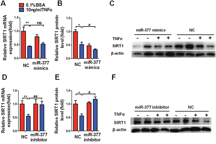 MiR-377 promotes inflammation and insulin-resistance via SIRT1 suppression.