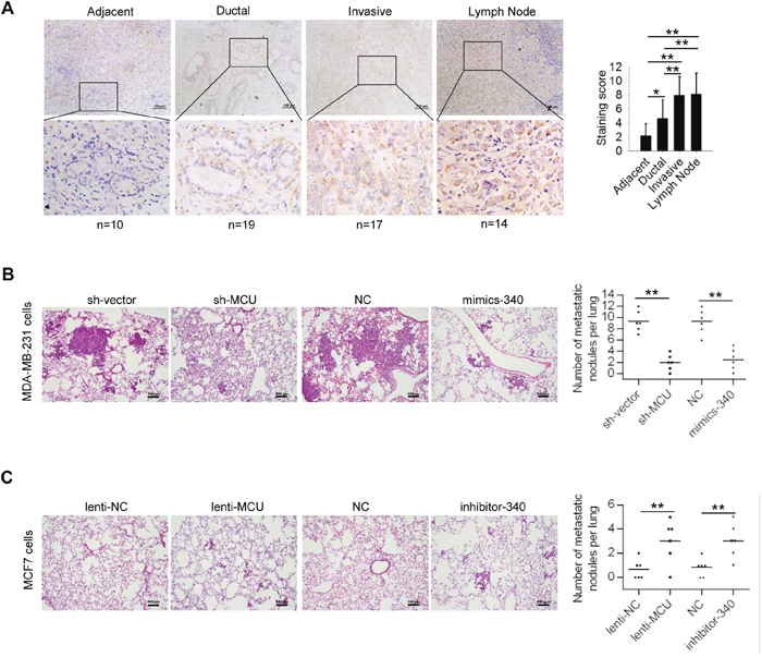 MCU and miR-340 expression regulate breast cancer metastasis in vivo.