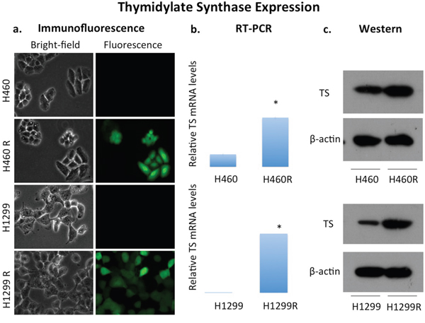 Overexpression of thymidylate synthase in NSCLC cell lines H460 and H1299.