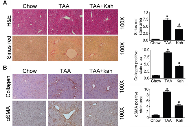Kahweol decreases TAA-induced hepatic fibrosis in mice.