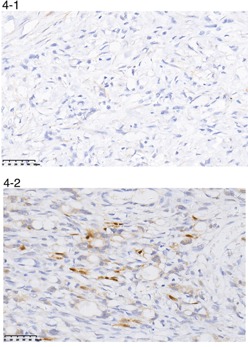 A representative image of negative (4-1) or positive (4-2) ER-&#x03B2; expression.