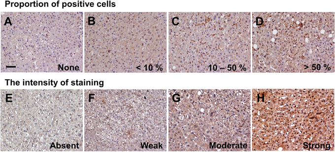 LC3 expression in the adjacent non-tumor tissues by immunohistochemistry staining.