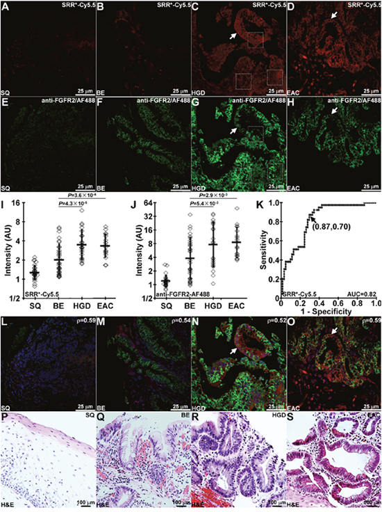 Binding of FGFR2 peptide to Barrett&#x2019;s neoplasia.