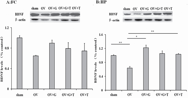 Ghrelin possible involve BDNF signaling pathway.