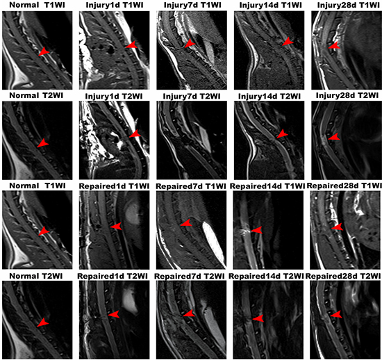 MRI imaging of Normal group, Injury group and Repaired group in the rat SCI model at 1 d, 7 d, 14 d and 28 d.
