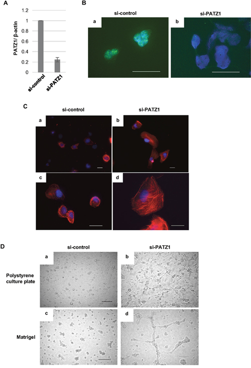 Effects of PATZ1 knockdown on the morphology of immortalized human thyroid epithelial cells, Nthy-ori 3-1 cells.