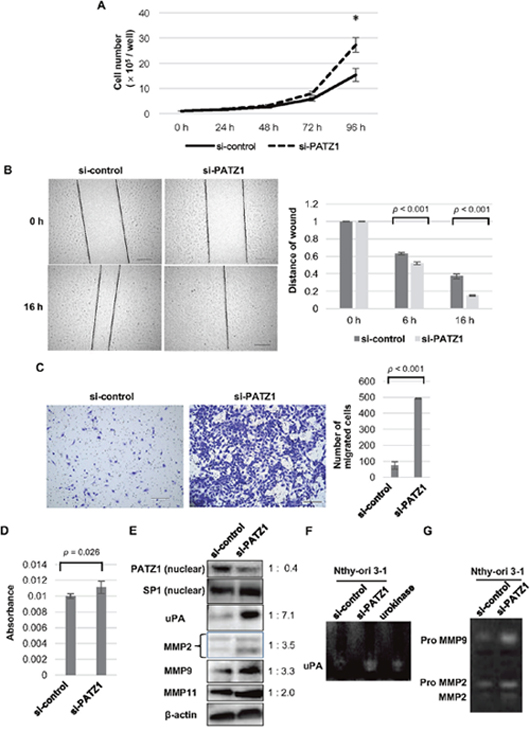 Effects of PATZ1 knockdown on cell proliferation, migration, and invasion in Nthy-ori 3-1 cells.