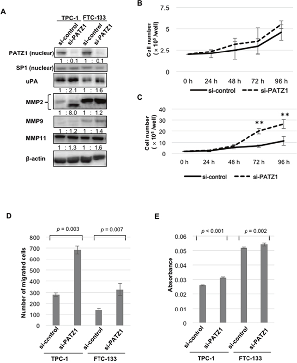 Effects of PATZ1 knockdown on the expression of proteinases, cell proliferation, migration, and invasion in DTC cell lines.