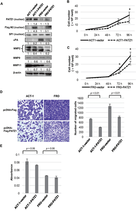 Effects of exogenously introduced PATZ1 in ATC cell lines.