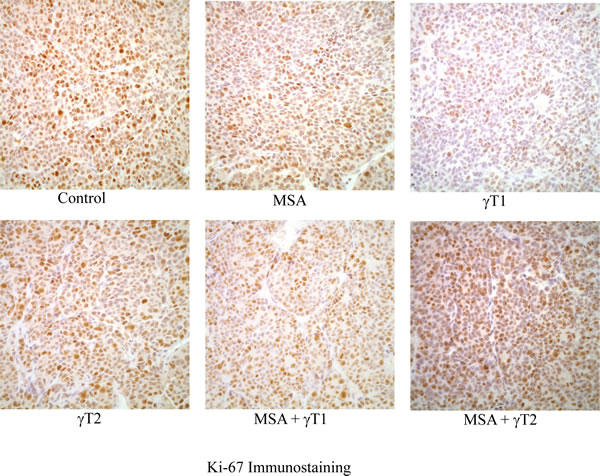 Effects of MSA and/or &#x3b3;T on tumor cell proliferation.