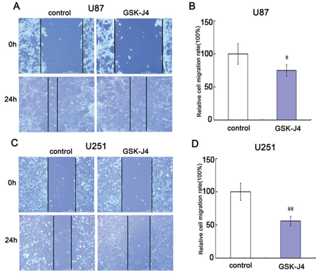 GSK-J4 inhibits cell migration of glioma cells.