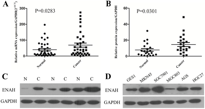 The mRNA and protein expression of ENAH is higher in human primary gastric adenocarcinoma surgical specimens and GC cell lines compared to controls.