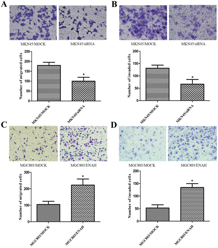 ENAH promotes cell migration and invasion in MKN45 and MGC803 cells.