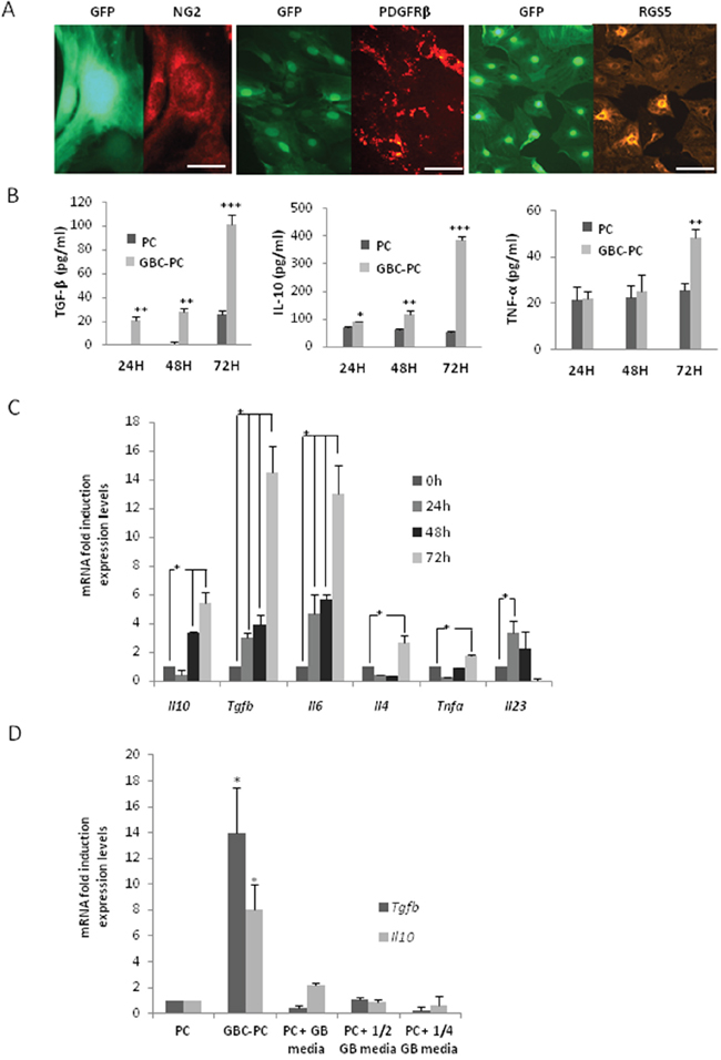 Pericytes interacting with GBM cells show an anti-inflammatory phenotype.