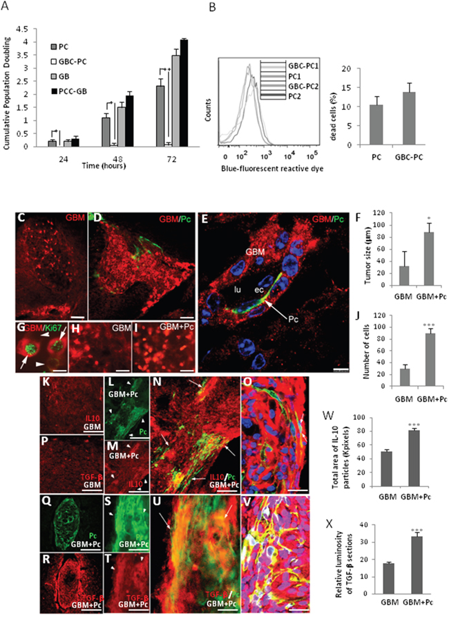 Pericytes interacting with GBM cells induce tumor growth.