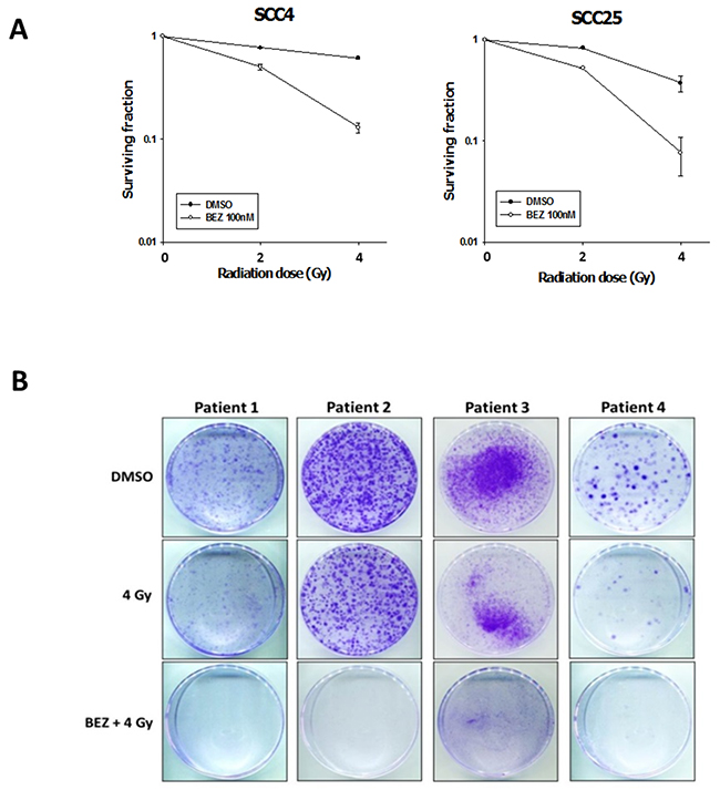 The dual PI3K/mTOR inhibitor enhances the radiosensitization of OSCC cells and patient-derived cells.
