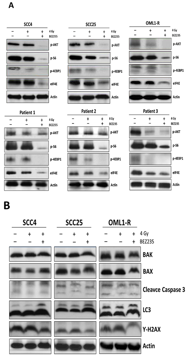 The dual PI3K/mTOR inhibitor sensitized OSCC cells to radiation, which led to reduced clonogenic survival by inhibiting AKT/mTOR signaling and inducing autophagy.