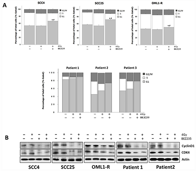Combination treatment with the dual PI3K/mTOR inhibitor and IR causes G1 cell cycle arrest in OSCC cells by regulating cell cycle-related proteins.