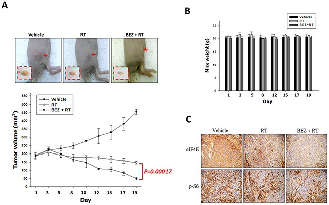 Treatment with a dual PI3K/mTOR inhibitor in combination with IR inhibits tumor growth of OML1-R xenografted tumor.