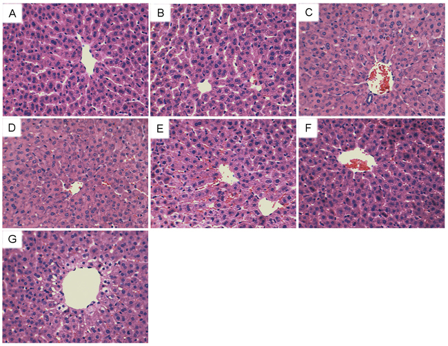 Effects of eriodictyol on As2O3-induced liver histopathologic changes.