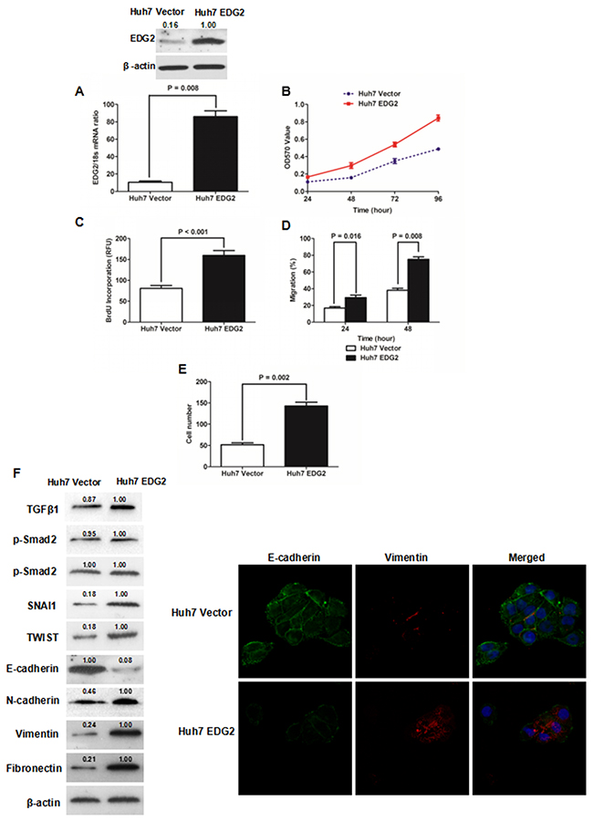Enforced expression of EDG2 promoted cell growth and induced EMT phenotype of Huh7 cells.