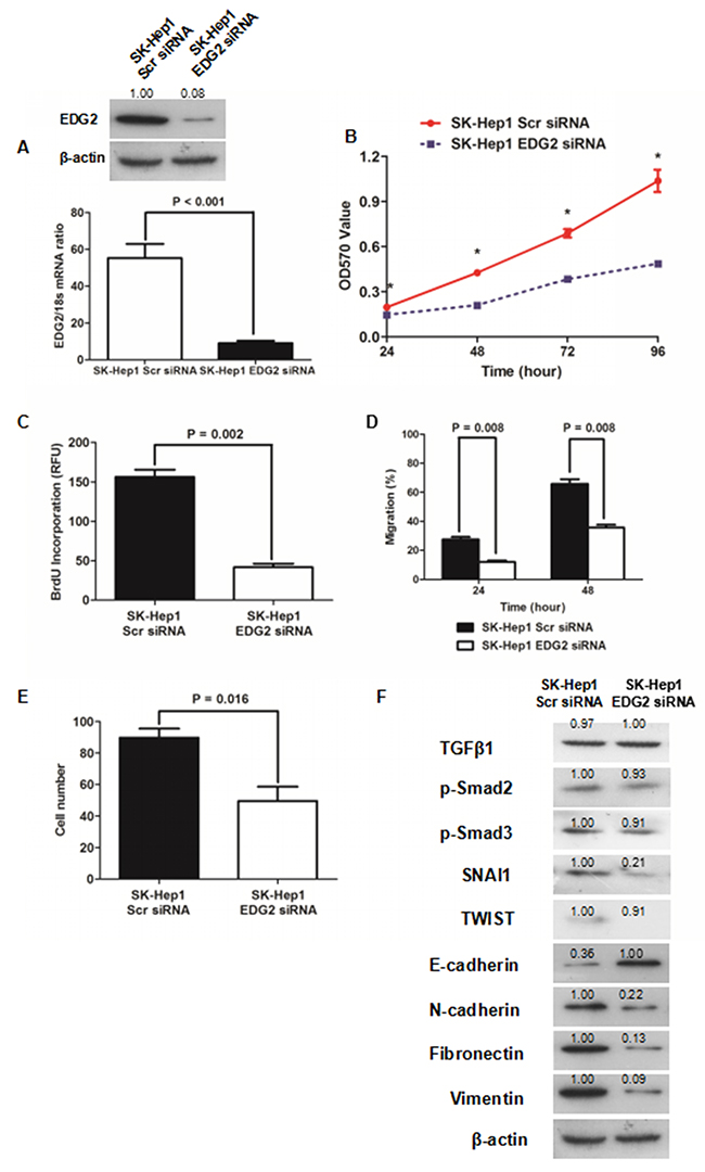 Knockdown of EDG2 repressed cell viability and proliferation and inversed EMT of SK-Hep1.