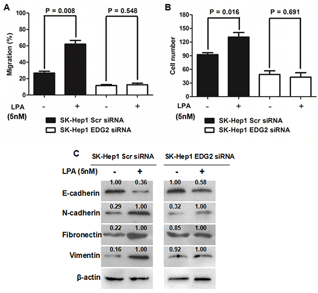 EDG2 played a vital role in LPA-induced EMT phenotype of SK-Hep1 cells.