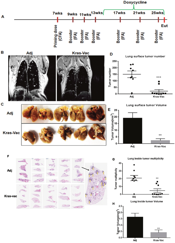 KRAS vaccine inhibited KRASG12D-driven mice in conditional CCSP-KRAS mice in prevention setting.